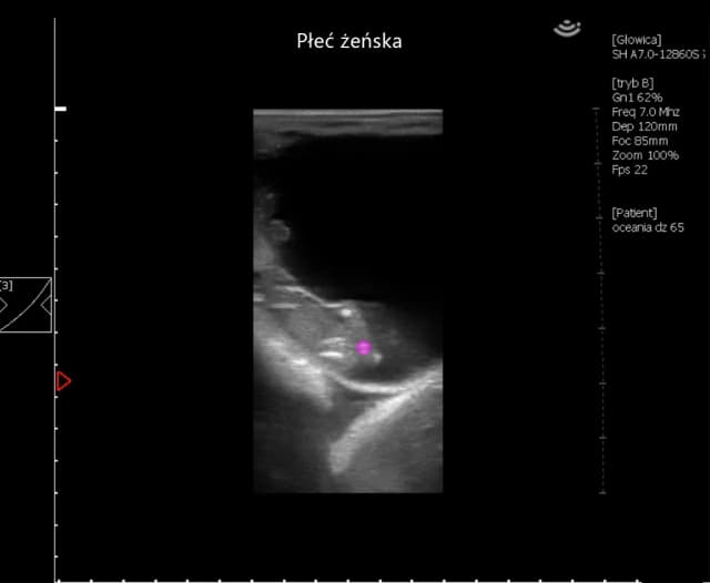 Jak rozpoznać ciążę u konia: objawy i metody diagnozowania Jak rozpoznać ciążę u konia: objawy i metody diagnozowania
